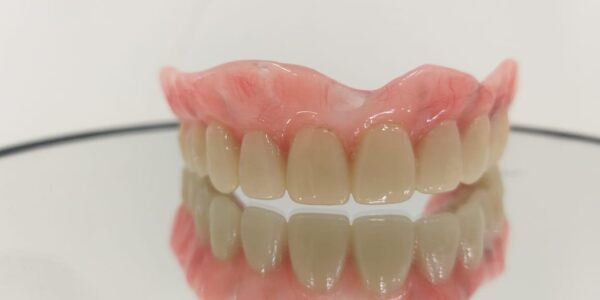 Implante dentário: Dentz Alphaville responde às principais dúvidas sobre procedimento