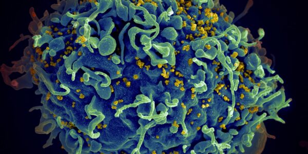 Paciente americano é o quarto caso de cura da Aids no mundo