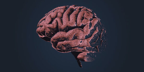 Fleury de Alphaville traz teste inédito no Brasil para diagnóstico de Alzheimer
